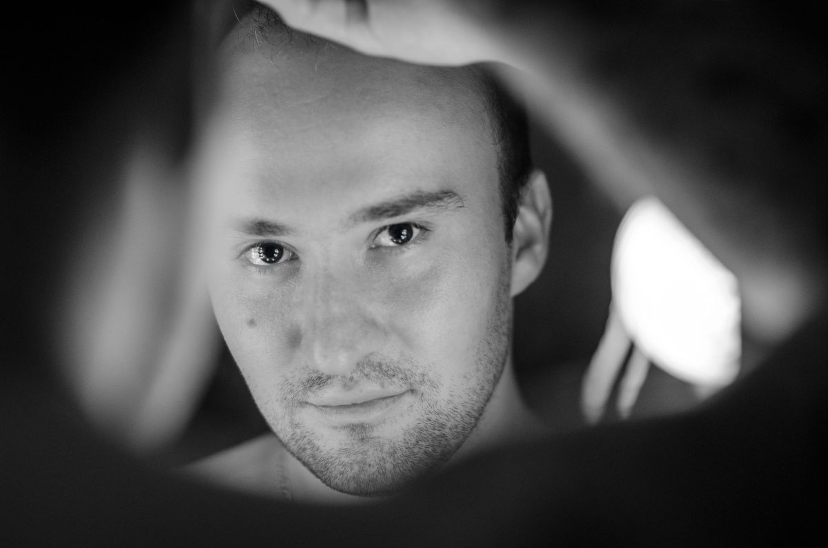 qué hacer si me estoy quedando calvo